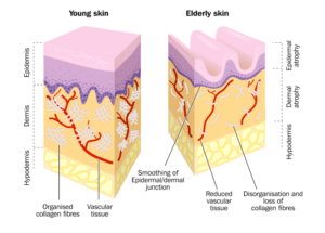 Young Skin vs. Old Skin