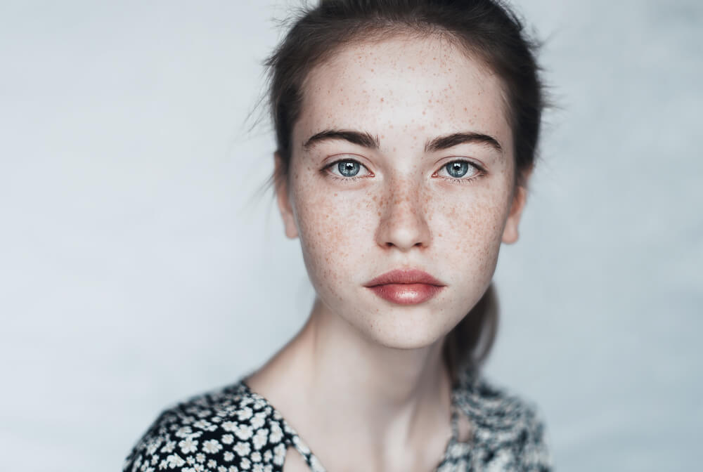 Hyperpigmentation Causes And Cures Vancouver Laser Clinic