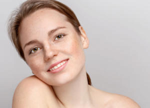 vancouver laser clinic rosacea