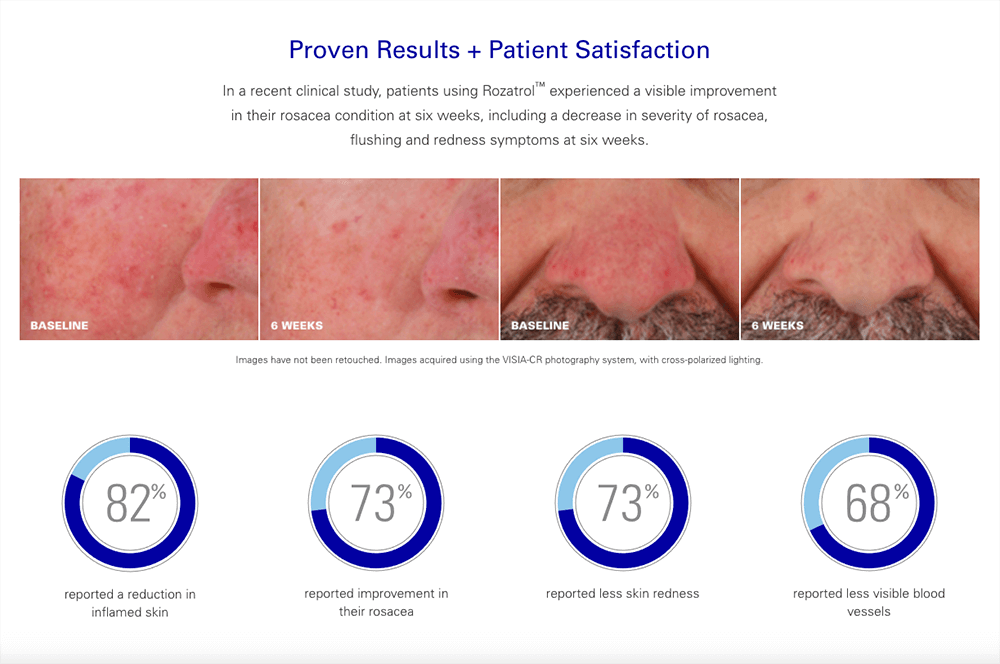 rozatrol-for-rosacea