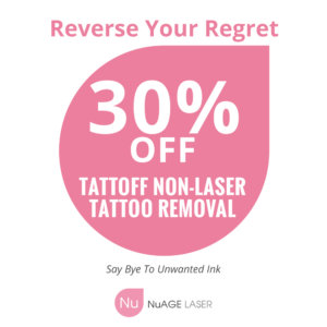 tattoo removal promotion
