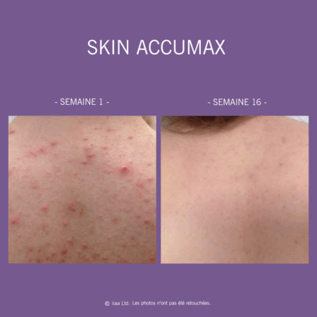 Skin Accumax - Image 11