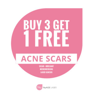acne scars promotion