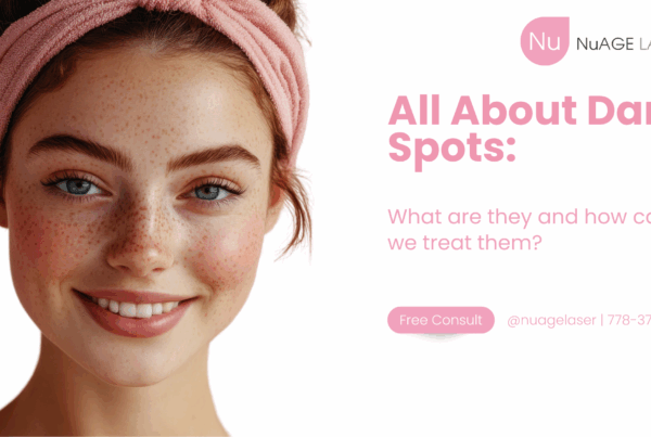 Dark Spots