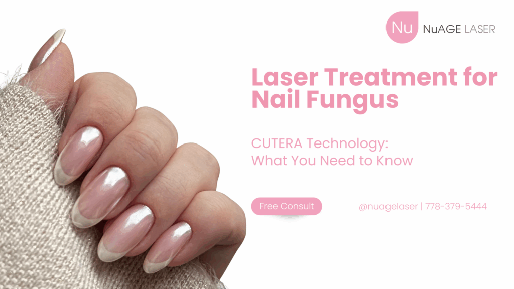 Laser for Nail Fungus