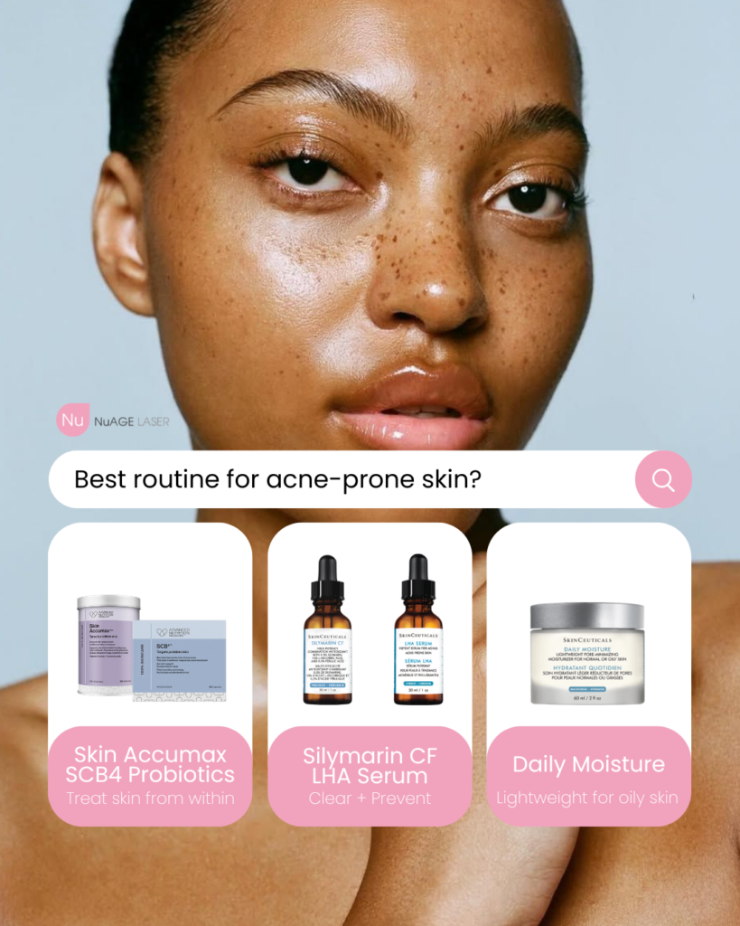 Acne Products