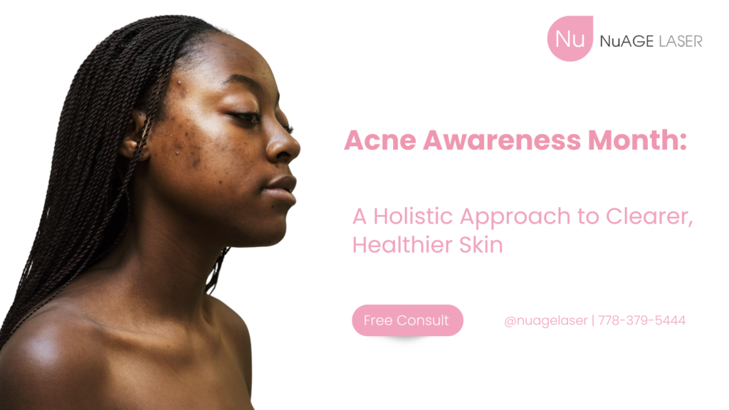 Acne Awareness Month Blog